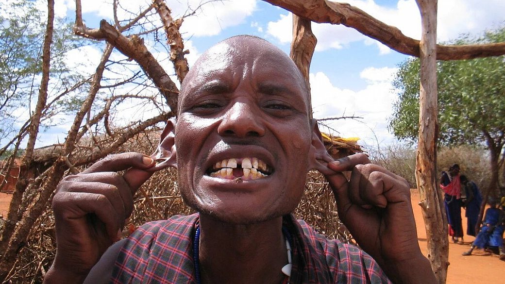 il mal d'africa esiste!!!